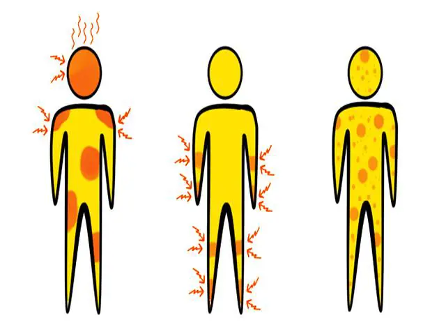 Příznaky a diagnostika slinivkových ​komplikací při celiakii